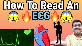 How to Read an ECG  ECG reading explained [upl. by Kellene]