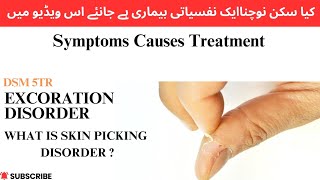 what is skin picking disorder Excoriation disorder Symptoms Causes Treatment Urdu DSM 5TR [upl. by Fanchette485]