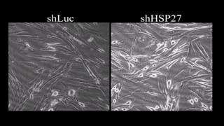 Knocking down of heatshock protein 27 directs differentiation of functional glutamatergic neurons [upl. by Anilrats]