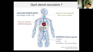 Comment prescrire une séance dhémodialyse intermittente [upl. by Yarrum62]