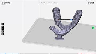 D3Splint WorkFlow Anterior Deprogrammer [upl. by Allen]