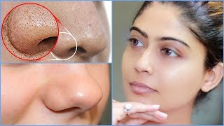 How To do Facial Cleanup At Home  Rinkal Soni [upl. by Audry442]