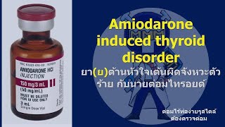 Amiodarone induced thyroid disorders [upl. by Ymeraj]