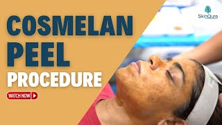 Cosmelan Peel Treatment  All about Cosmelan Peel  Antiageing Treatment Delhi  SkinQure [upl. by Yhtrod]