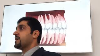 orthodontist etiology of malocclusion 1 [upl. by Neelrad]