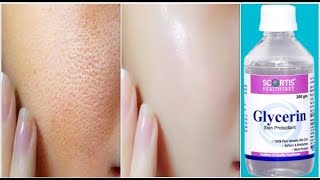 Use Glycerin This Way Your Skin Will Look So Young Tight Spotless amp Scar Free [upl. by Emirej771]