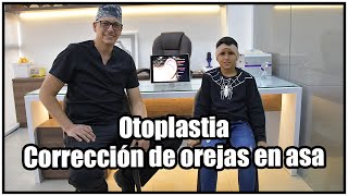 Otoplastia  Corrección de orejas en asa [upl. by Eirallam]