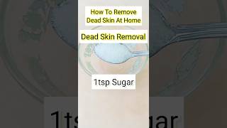 Pedicure Dead Skin Removal At Home l Dead Skin Removal ytshort youtubeshorts shorts [upl. by Egedan]