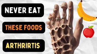 8 Foods To Avoid With Arthritis  Inflammatory Foods To Avoid  Rheumatoid Arthritis  VisitJoy [upl. by Enelec]