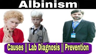 Albinism  Causes  Lab diagnosis  Prevention [upl. by Maurine361]