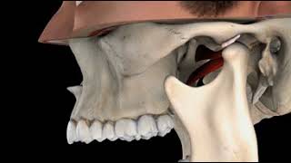 TMJ with Reduction [upl. by Lyndsey]