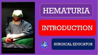 HEMATURIA  INTRODUCTION [upl. by Livvyy]