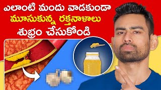 మూసుకున్న రక్తనాళాలను Blocked Arteries శుభ్రం చేయండి ఈ 5 పదార్థాలతో  Fit Tuber Telugu [upl. by Anom235]