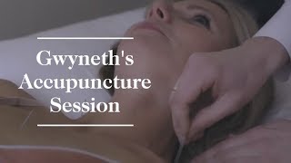 Gwyneth Paltrows Acupuncture Session  goop [upl. by Aranat475]