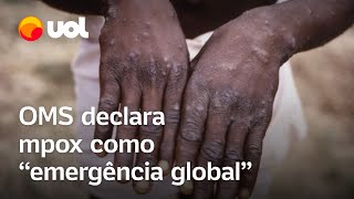 OMS declara mpox como emergência global a primeira desde covid19 [upl. by Devina]