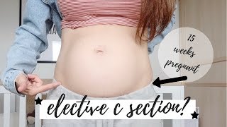 ELECTIVE C SECTION  15 WEEKS PREGNANT UPDATE UK [upl. by Maupin989]