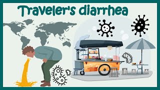 Traveler’s Diarrhea  Causes Risk Factors Symptoms Diagnosis Treatment  Animated biology [upl. by Holden204]