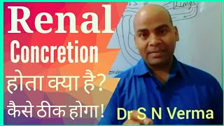 Renal Concretion Homeopathic MedicineRenal StoneRenalCalculiकिड़नी की पथरी के लिए होम्योैथिक दवा [upl. by Melodie]