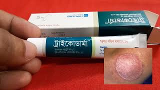 দাউদএকজিমাদাদত্বকের ছত্রাকের চিকিৎসা  Tricoderma Cream Review Bangla  ট্রাইকোডার্মা ক্রীম [upl. by Annoerb]