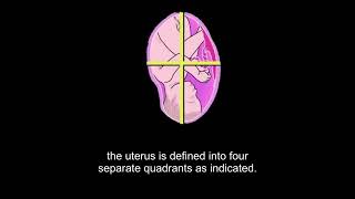 Ultrasound of amniotic fluid assessment and macrosomia Level 1 [upl. by Sualokcin]