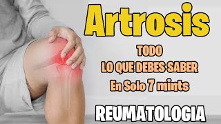 ARTROSIS  causas sintomas y tratamiento  Dolor en las articulaciones [upl. by Allesiram473]