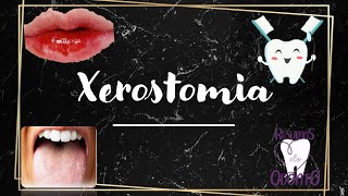 Xerostomia  Resumos de Odonto [upl. by Nitsej383]