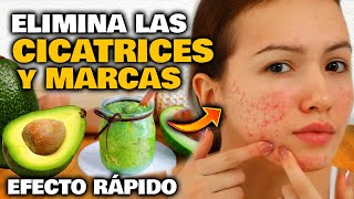 Elimina TODAS las CICATRICES y MARCAS de tu Rostro y tu Piel  Mascarilla y Crema Facial Casera [upl. by Warfourd]