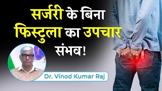 Fistula Ka Non Surgical Treatment  सर्जरी के बिना फिस्टुला का उपचार  Dr Vinod Kumar Raj [upl. by Myrlene]