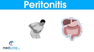 Peritonitis  causes signs and symptoms and treatment [upl. by Seeto]