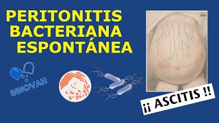 Peritonitis bacteriana espontánea  ¿Cómo diagnosticarla y tratarla [upl. by Noedig743]