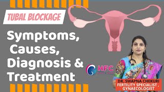 Fallopian Tube Blockage Symptoms Causes Diagnosis and Treatment  HFC [upl. by Sedicla]