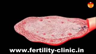 IVFAssisted Reproductive Techniques or Test Tube Baby Principles amp Procedures In Pondicherry [upl. by Dnalyr]