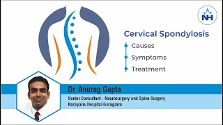 The Causes Symptoms and Treatment of Cervical Spondylosis by Dr Anurag Gupta [upl. by Nynahs]