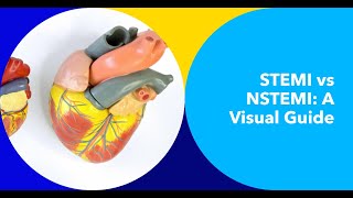 Deciphering STEMI vs NSTEMI on ECG A Comprehensive Visual Guide [upl. by Alyos]