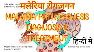 Malaria pathology diagnosis treatment amp prevention in hindi [upl. by Anire]