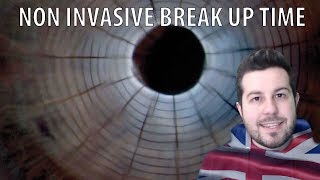 Non Invasive Break Up Time  tear Film Evaluation 4 ENG [upl. by Notffilc956]