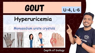 hyperuricemia and gout  gout Pathophysiology  gout nursing  gout  hyperuricemia gout sgsir [upl. by Niamreg]