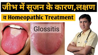 Glossitis  जीभ में सुजन के कारण लक्षण व् इलाज  Glossitis Homeopathic Treatment  Glossitis Tongue [upl. by Jeu235]