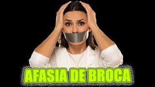 La increíble realidad de la afasia de Broca😱  3 min ⏰ Neuropsicología [upl. by Imoin]