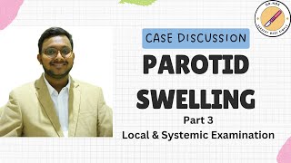 PAROTID SWELLING Case Discussion Part 3Surgery Made SimpleSMS by NBK [upl. by Frodeen296]