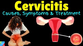 Cervicitis – Symptoms Causes Diagnosis Treatment Complications Prognosis [upl. by Schulein733]