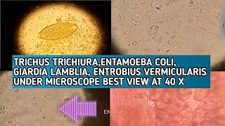 Trichus trichuriaEntamoeba coliGiardia lambliEntrobius vermicularis best microscopic view at 40X [upl. by Astraea640]