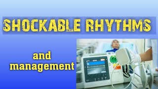 shockable rhythms and its management [upl. by Radcliffe]