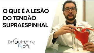 Lesão do Tendão Supraespinhal  Dr Guilherme Noffs [upl. by Anrahc]