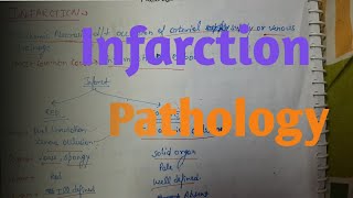 Infarction Pathology [upl. by Terese853]