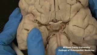 Ventral brainstemhypothalamus neuroanatomy hypothalamus brainstem anatomymedicalstudentbrain [upl. by Maurilia359]