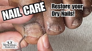 Nail Care Dry Toenails nails satisfying 🤤 [upl. by Yasui]