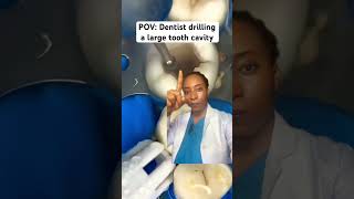 This cavity is BIG cavity cavities toothdecay teeth shorts youtubemadeforyou youtubeshorts [upl. by Ongun]