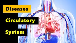 Diseases of the Circulatory System I Grade 9  Q1 l PART 2 [upl. by Ecirtnahc]