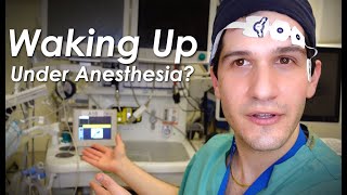 Waking up during surgery The truth about general anesthesia amp how awareness is prevented [upl. by Ameluz]